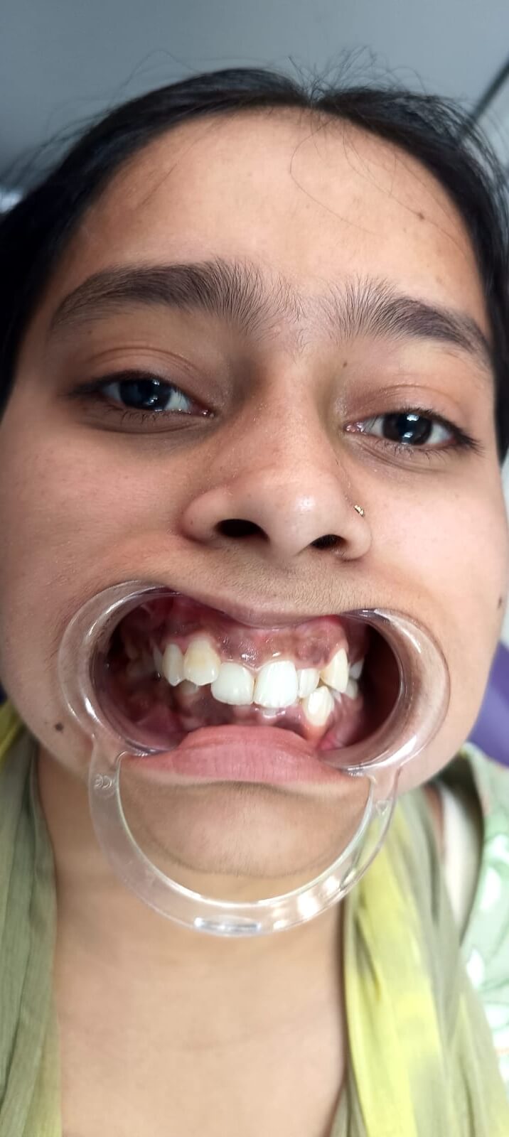 img 20260622 064719