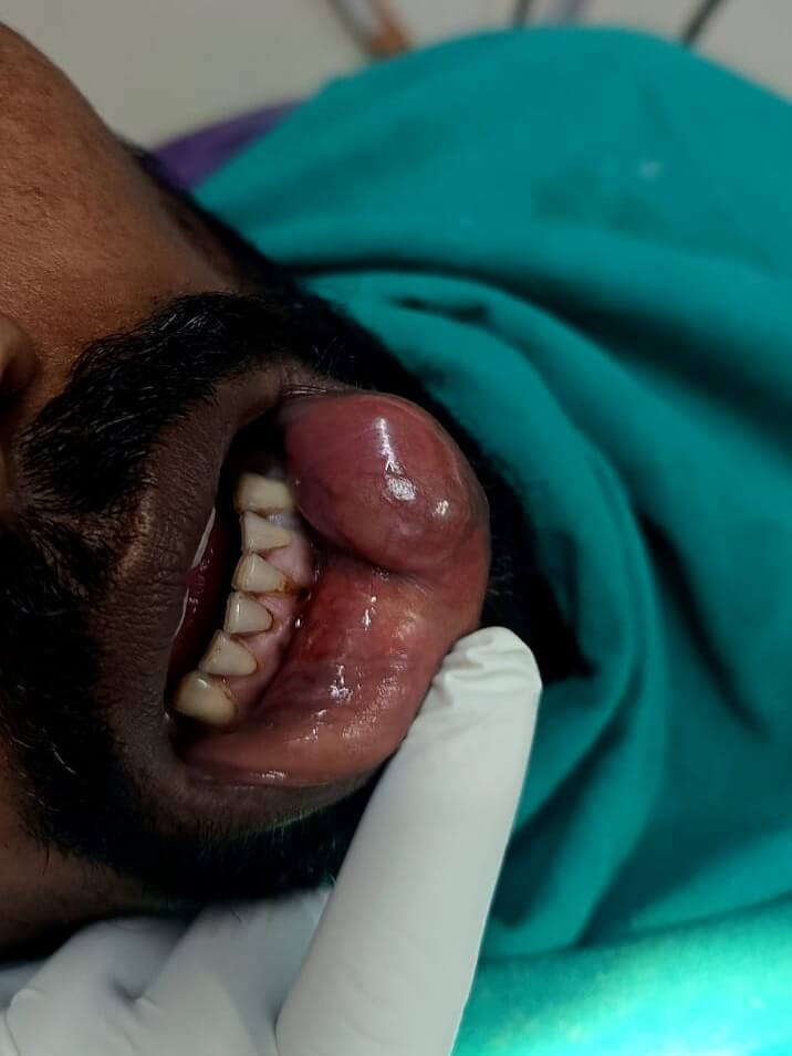 img 20260622 075101