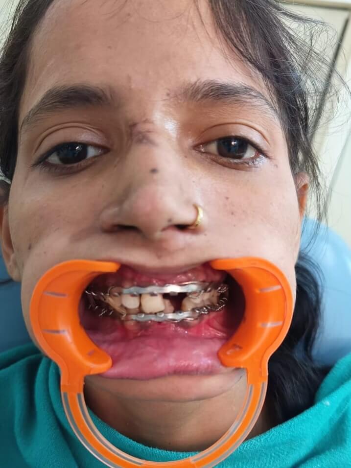 img 20260622 075758