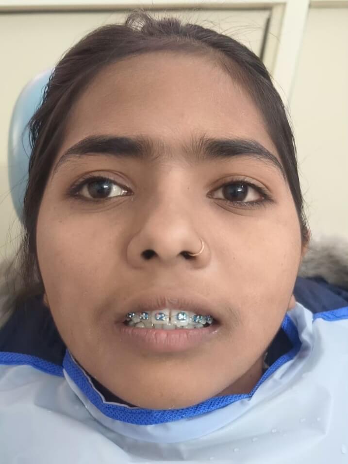 img 20260622 080112